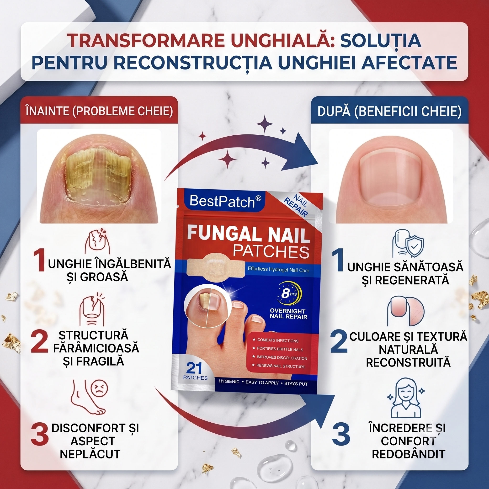 BestPatch – Redă frumusețea unghiilor tale